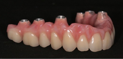 Campus clinic formation prothese implants